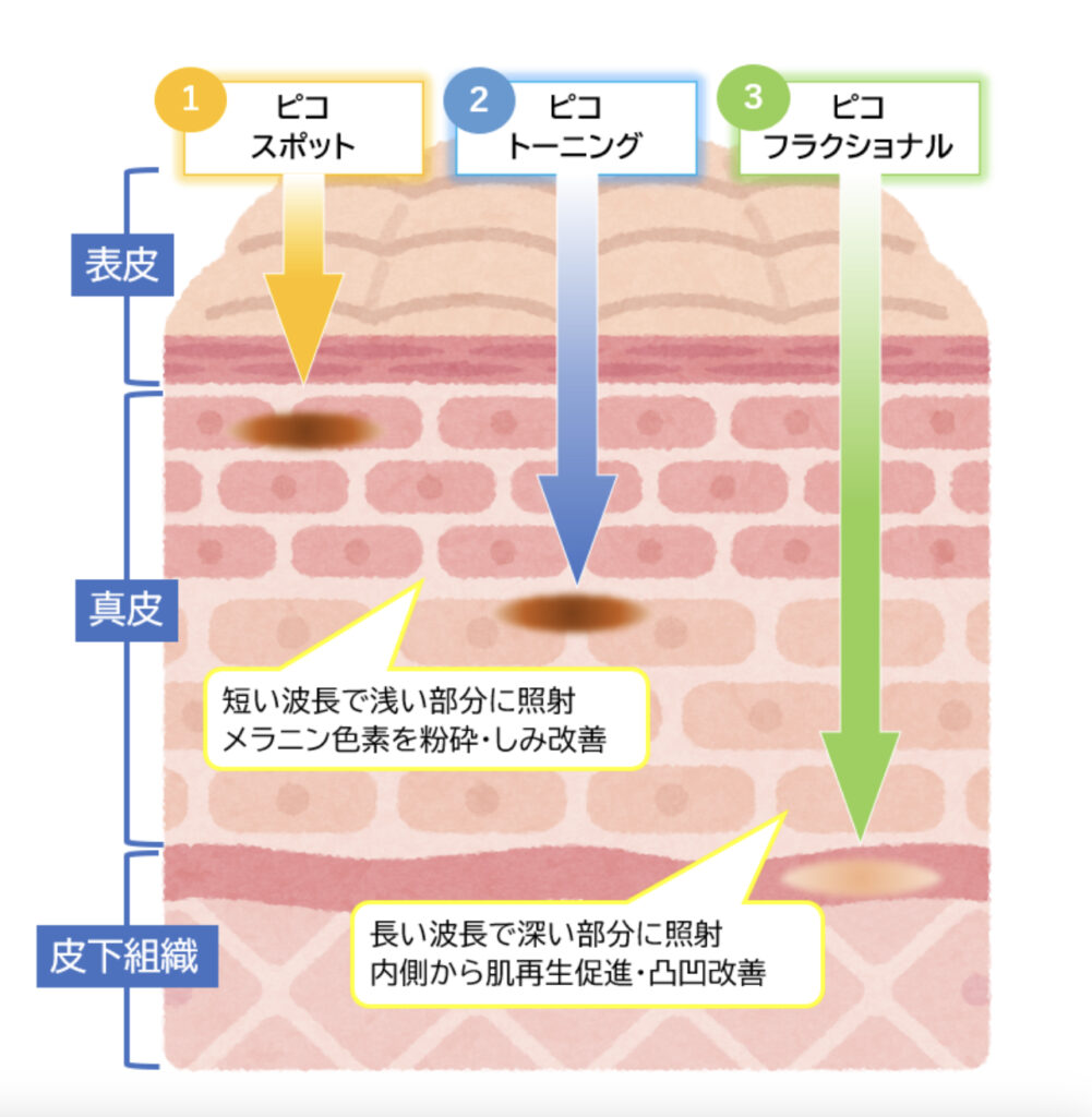 ピコシュア深さ