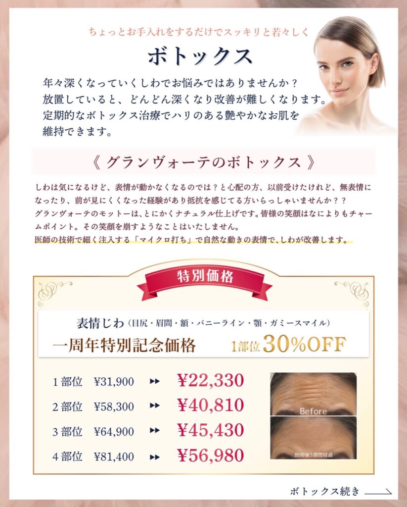 ボトックスキャンペーン